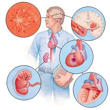 Cardiol verhindert die Entstehung von Begleiterkrankungen